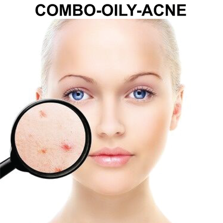 Glycolic Peel System for Combo/Oily/Ance Skin